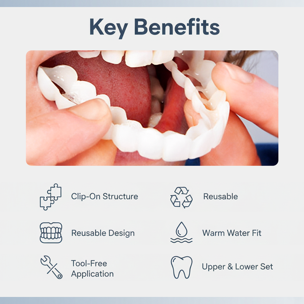 Dental Veneer Set - Upper Coverage - Lower Coverage